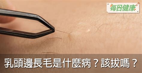 乳頭 長毛|乳頭邊長了毛，是什麼病？該不該拔？讓名醫一次解釋給您聽｜每